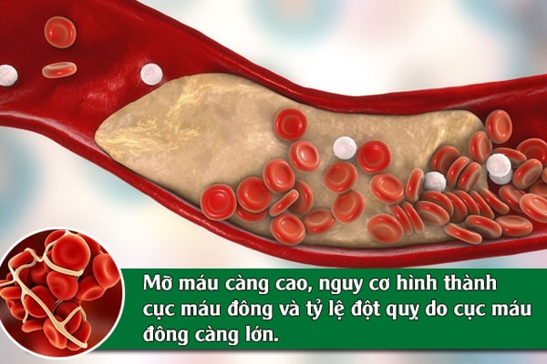 Hình ảnh: Mở máu càng cao, nguy cơ hình thành cục máu đông